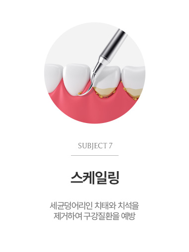 스케일링